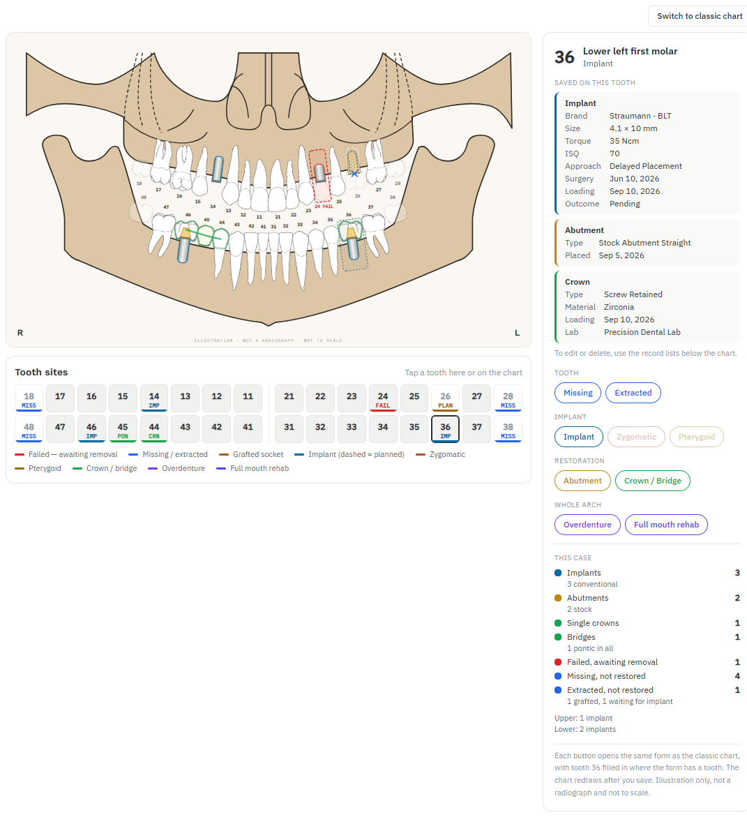 Panoramic chart of a sample patient with tooth 36 selected and its implant, abutment and crown details in the side panel