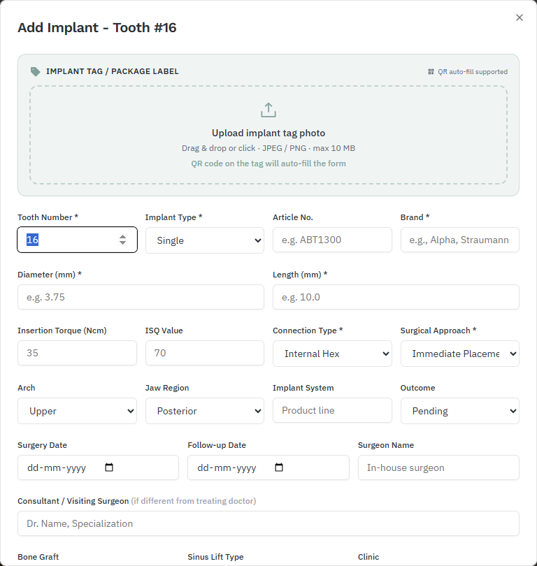 Add Implant form for tooth 16 with tag upload, tooth number, brand, diameter, length, torque, ISQ and other fields