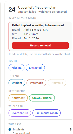 Side panel for tooth 24: failed implant waiting to be removed, with a red Record removal button